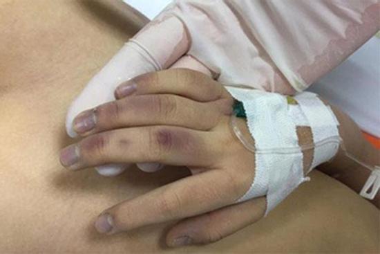 Vụ bé gái 6 tuổi tử vong: Nạn nhân bị bố đánh vì học chậm?