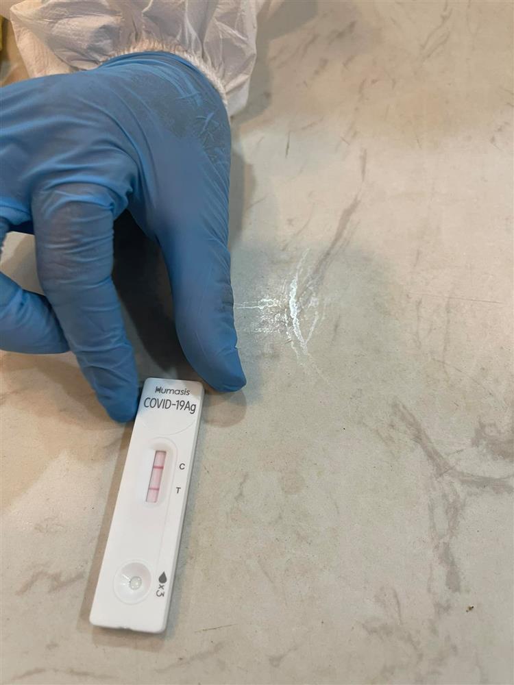 Ca sĩ Quách Tuấn Du dương tính Covid-19-2