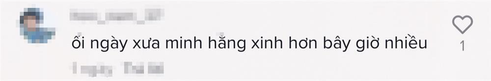 Minh Hằng bị đào clip thời đen đúa, răng thưa 15 năm trước-9