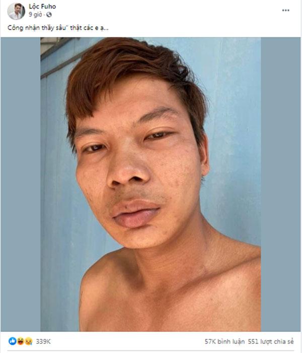 Bị chê xấu hơn vợ, Lộc Fuho phản ứng gắt hút 11k like-3