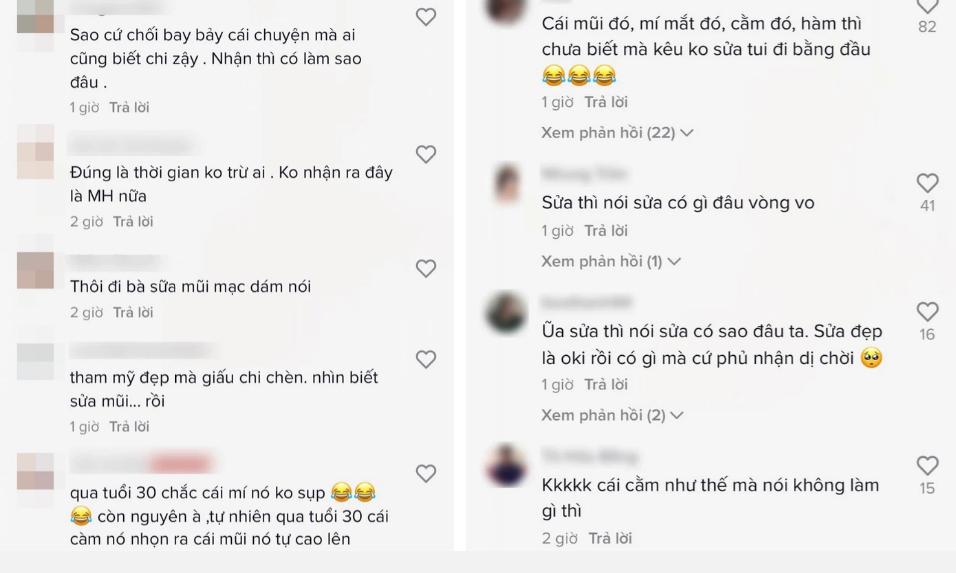 Bị hỏi chuyện dao kéo, Minh Hằng vòng vo khiến netizen phát cáu!-2