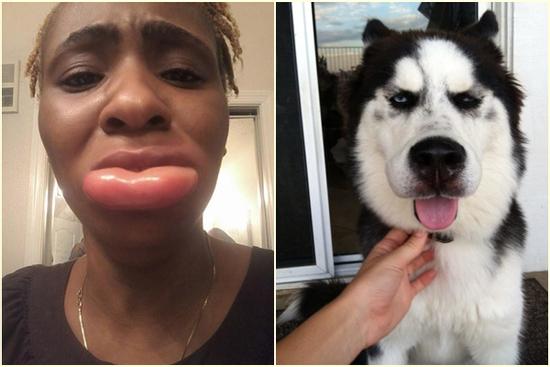 Cạn lời với những 'khuôn mặt đáng thương' bị ong đốt túi bụi