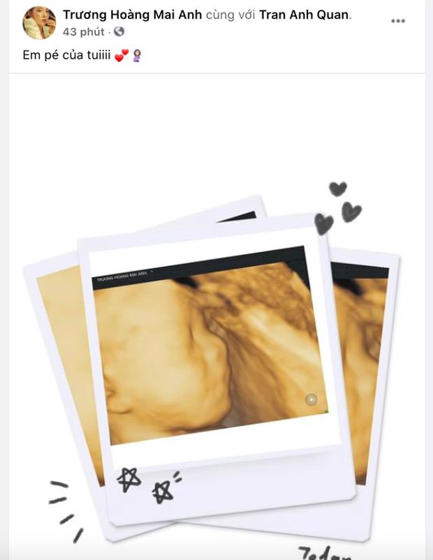 Jaykii đổi trạng thái đã kết hôn, vợ tương lai khoe ảnh siêu âm-2