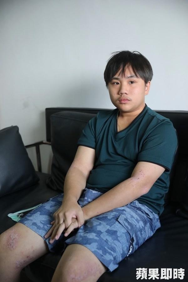 Thần đồng bị bố mẹ coi như máy in tiền khổ sở vì bệnh tật đày đọa-6