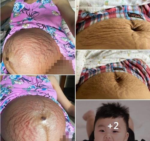 Hòa Minzy công khai bụng nát tươm sau 2 năm sinh nở-8