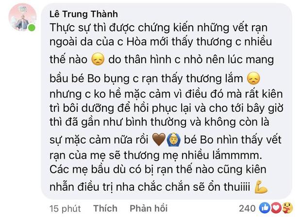 Không chỉ rạn chi chít bụng, Hòa Minzy còn rụng hết tóc-1