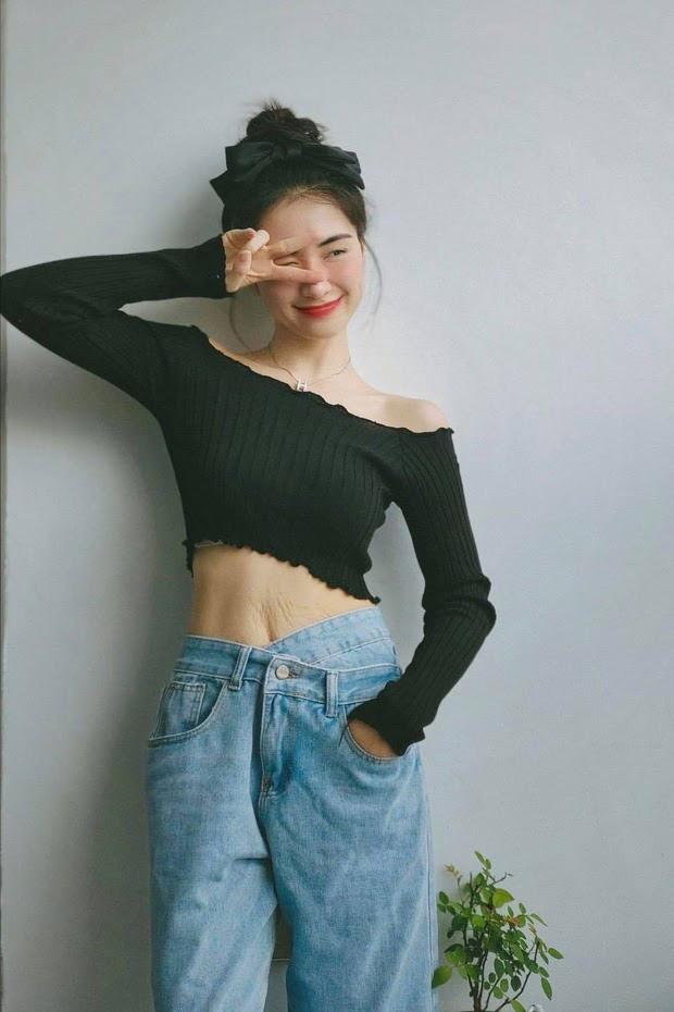 Không chỉ rạn chi chít bụng, Hòa Minzy còn rụng hết tóc-7