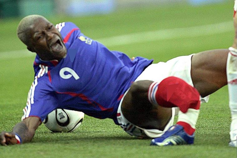 Tai nạn bóng đá: Chân tay biến dạng, xương đâm ra khỏi thịt-3