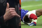 Tai nạn bóng đá: Chân tay biến dạng, xương đâm ra khỏi thịt
