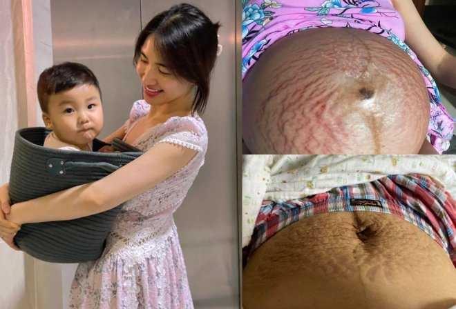 Chiếc bụng rạn của Hòa Minzy: Phụ nữ hãy yêu thương cơ thể mình!-1