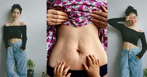 Chiếc bụng rạn của Hòa Minzy: Phụ nữ hãy yêu thương cơ thể mình!-2