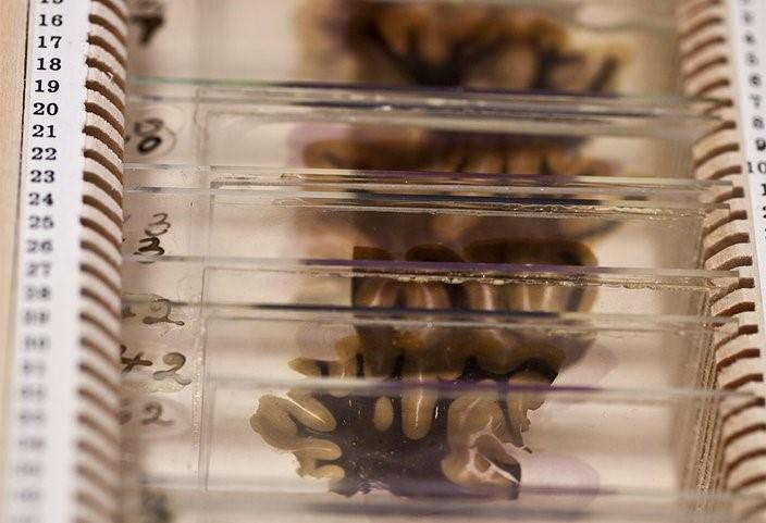 Bảo tàng rùng rợn lưu giữ một phần bộ não Einstein-2