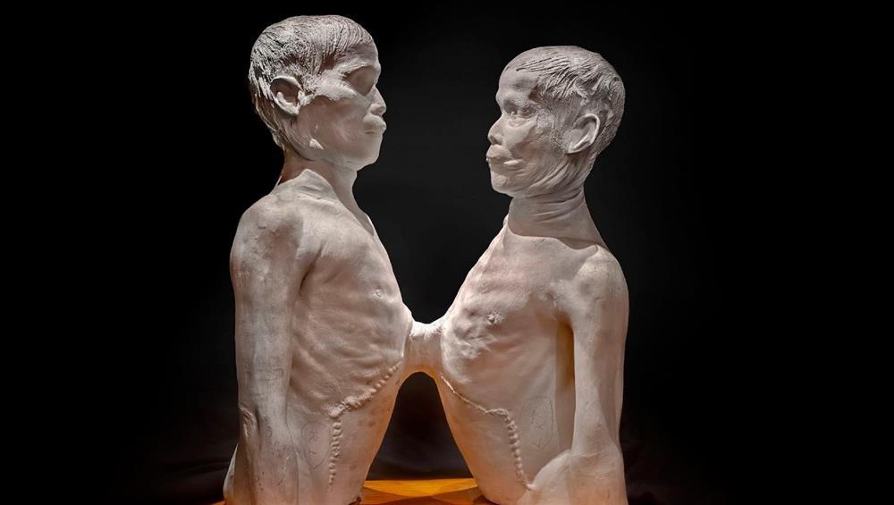 Bảo tàng rùng rợn lưu giữ một phần bộ não Einstein-4