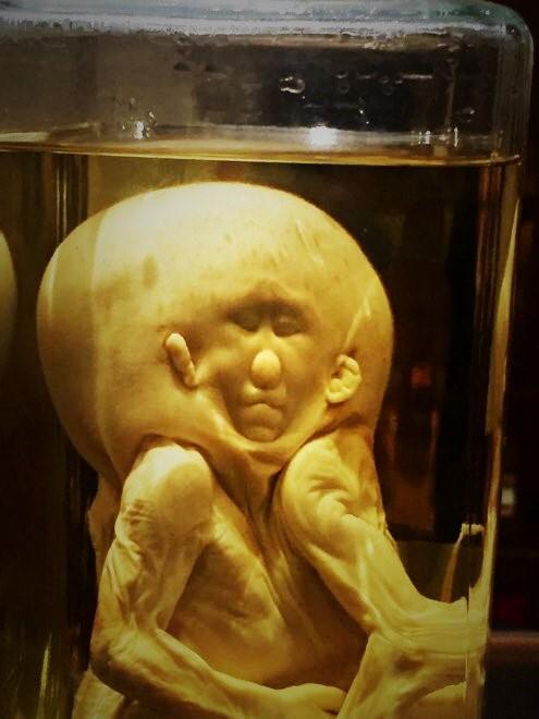 Bảo tàng rùng rợn lưu giữ một phần bộ não Einstein-5