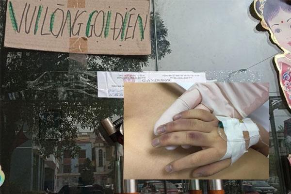 Lỡ tay khi dạy học, bố ruột đánh bầm tím mặt con gái 6 tuổi-2