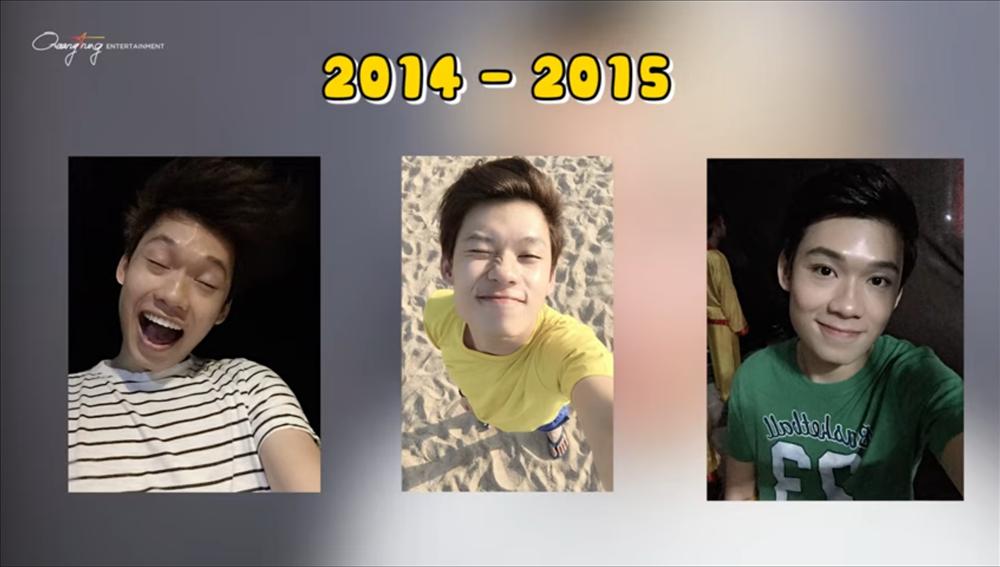 Quang Trung làn da chi chít mụn vì sai lầm nhiều người mắc-4