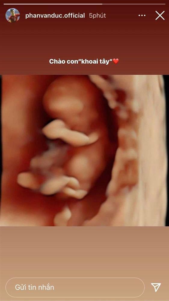 Cầu thủ Phan Văn Đức khoe bà xã mang thai lần 2-2