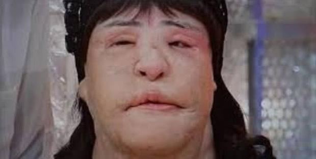 Thảm hoạ thẩm mỹ Han Mi Ok: Tự tiêm dầu ăn và cái chết chấn động-11