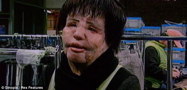 Thảm hoạ thẩm mỹ Han Mi Ok: Tự tiêm dầu ăn và cái chết chấn động-12