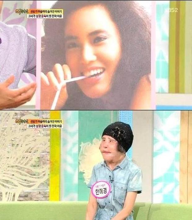 Thảm hoạ thẩm mỹ Han Mi Ok: Tự tiêm dầu ăn và cái chết chấn động-13