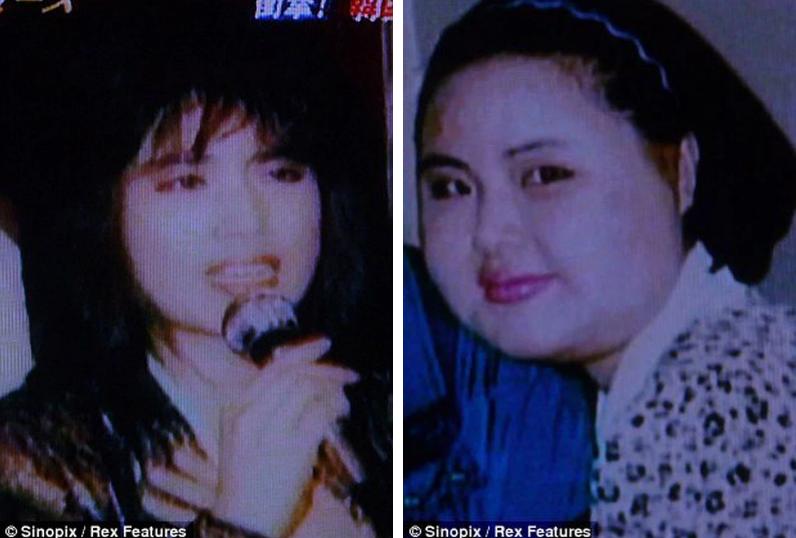 Thảm hoạ thẩm mỹ Han Mi Ok: Tự tiêm dầu ăn và cái chết chấn động-5