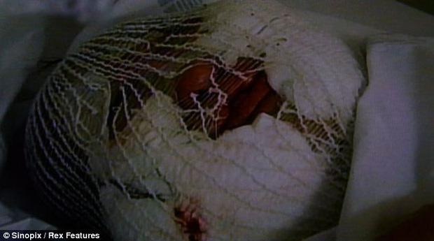 Thảm hoạ thẩm mỹ Han Mi Ok: Tự tiêm dầu ăn và cái chết chấn động-10