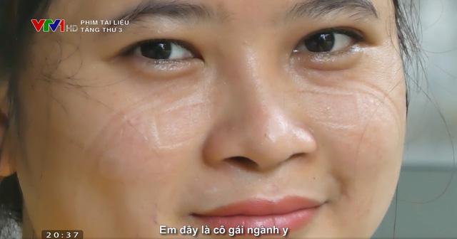 Tầng Thứ 3: Bên trong tầng sinh tử điều trị bệnh nhân COVID-19-10