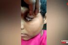 Video: Kinh ngạc thiếu nữ khóc ra 'đá' ở Ấn Độ