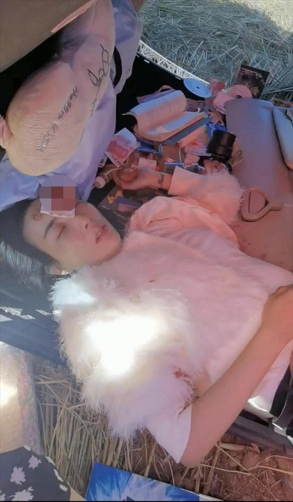 Mỹ nhân Cbiz gặp tai nạn suýt chết, phải khâu 54 mũi-3