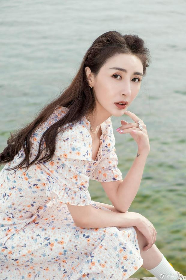 Mỹ nhân Cbiz gặp tai nạn suýt chết, phải khâu 54 mũi-4