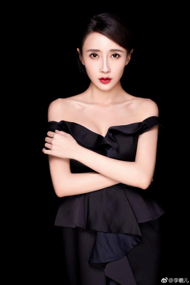 Mỹ nhân Cbiz gặp tai nạn suýt chết, phải khâu 54 mũi-5