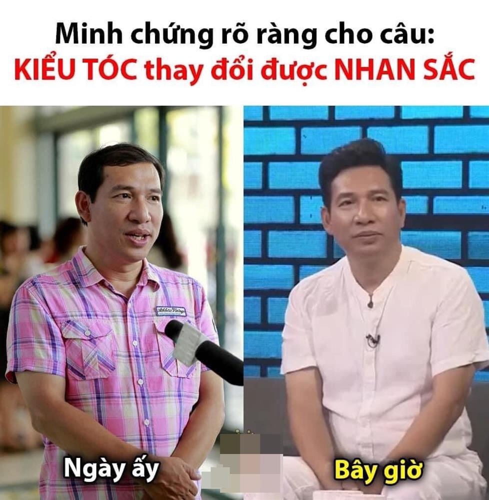 Quang Thắng bị nghi cấy tóc vì đầu hói tự nhiên bốc hơi-5