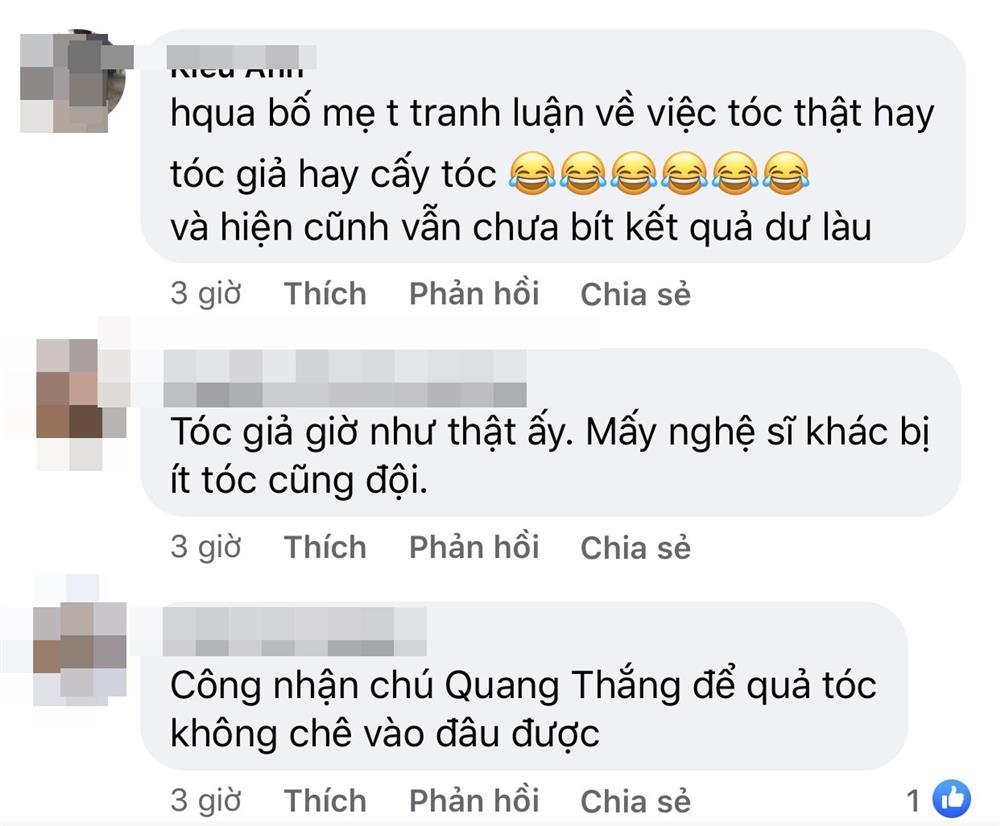 Quang Thắng bị nghi cấy tóc vì đầu hói tự nhiên bốc hơi-6