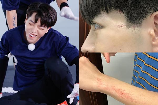 Bị hỏi chuyện Jack ném chai nước vào mặt, Trương Thế Vinh đáp gắt-5