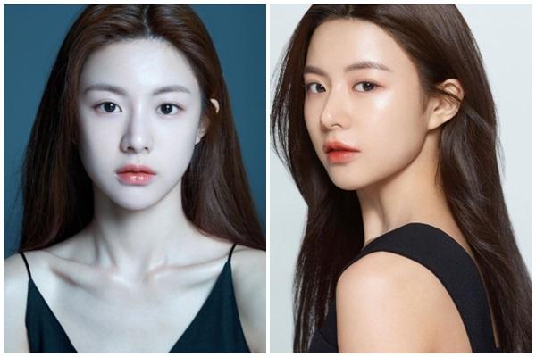 Chi hơn 2 tỷ phẫu thuật thẩm mỹ, 9X nhận cái kết đắng-6