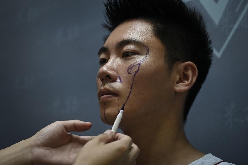 Giới trẻ Trung Quốc đang lạm dụng phẫu thuật thẩm mỹ-2