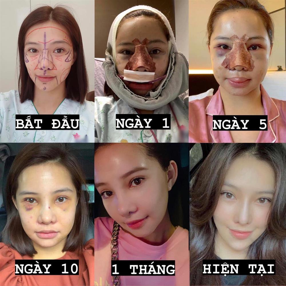 Ngoại hình hiện tại Lưu Đê Ly sau 3 năm sang Hàn Quốc thẩm mỹ-5