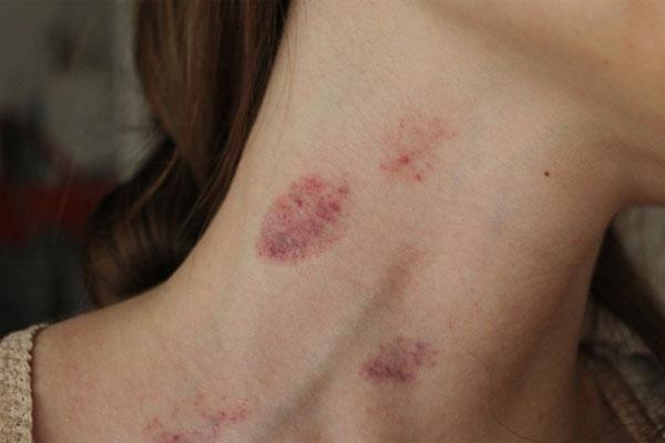 Kỹ thuật kiss siêu đẳng bậc thầy phòng the chưa chắc đã biết-9