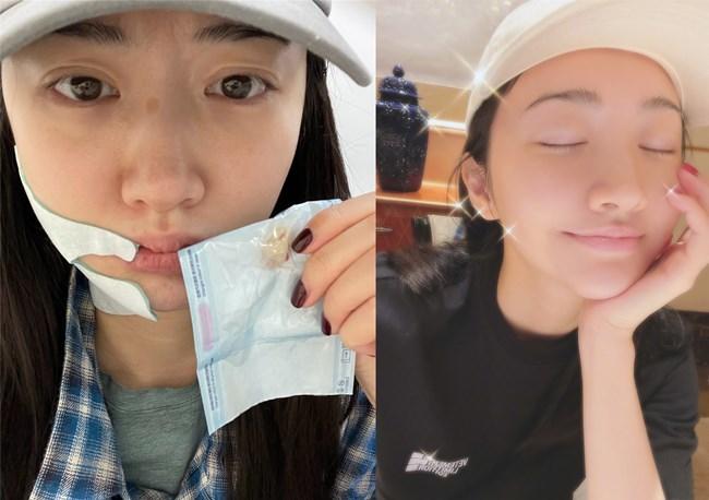 Lâm Duẫn và Cảnh Điềm khoe mặt mộc, tự nhận khuyết điểm-5