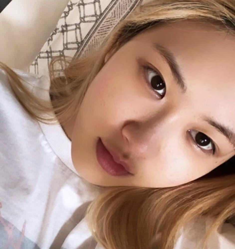 Rosé từng khốn đốn vì một bước skincare ngược đời-5