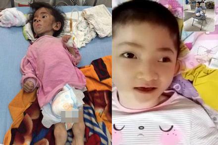 Ngoại hình đổi khác bé gái Lào Cai sau 5 năm được nhận nuôi