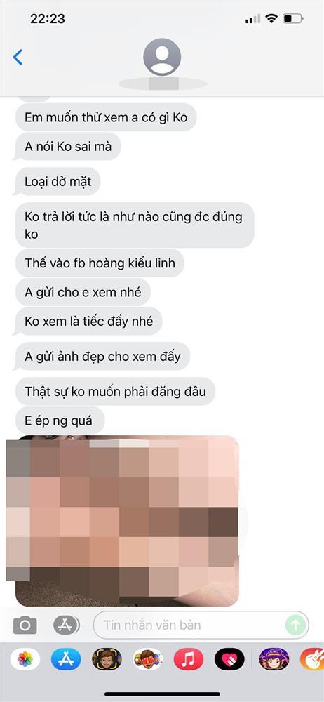 Vợ 9X bị chồng bạo hành, dùng gậy sắt đánh biến dạng mặt-5