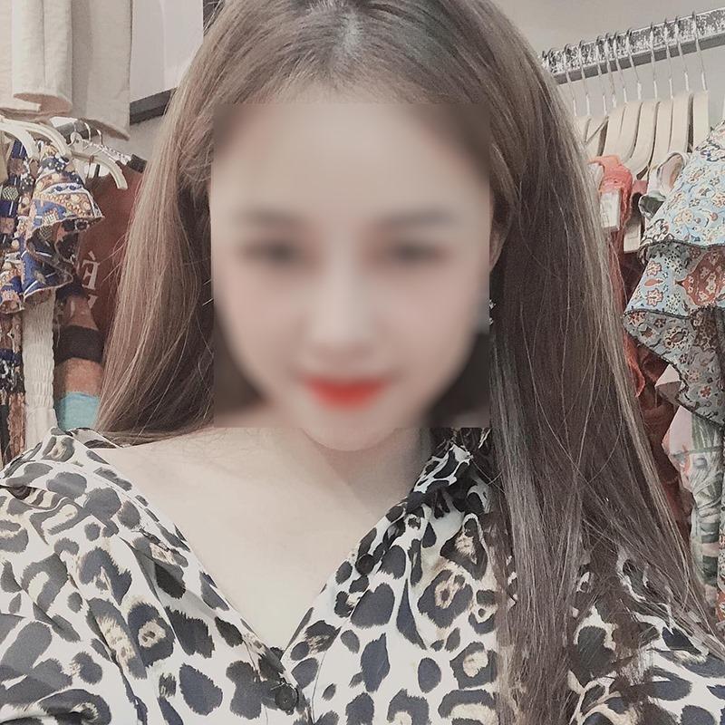 Vợ 9X bị chồng bạo hành, dùng gậy sắt đánh biến dạng mặt-6