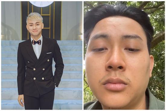 Ngoại hình khác lạ của Hoài Lâm khiến nhiều người lo lắng