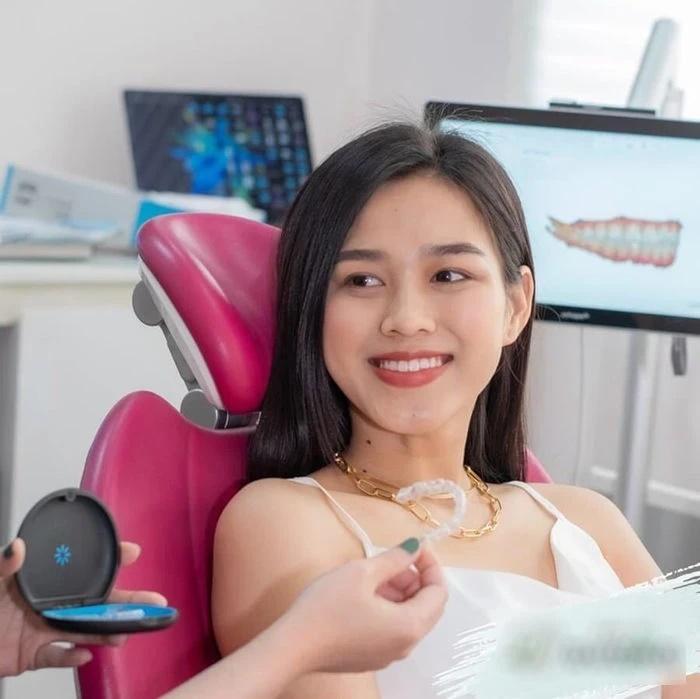 Đỗ Thị Hà khoe nhan sắc xinh đẹp sau khi tháo niềng răng-2