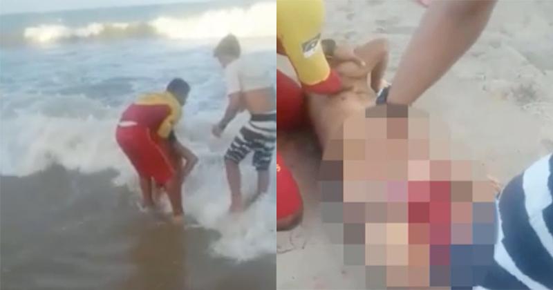 Thanh niên bị cá mập cắn đứt của quý khi tắm biển ở vùng cấm-2