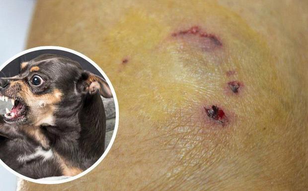 Cao Bằng: Nam thanh niên tử vong sau 2 năm bị chó dại cắn-1