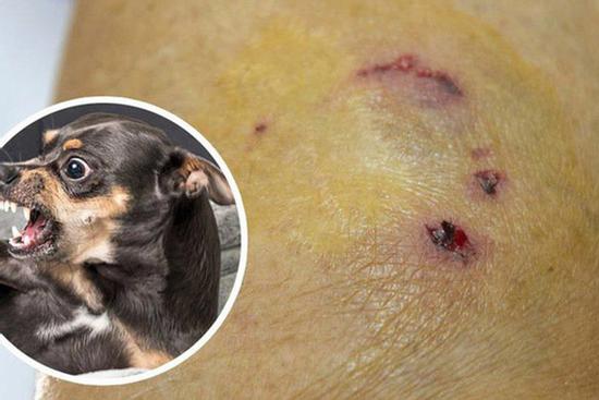 Cao Bằng: Nam thanh niên tử vong sau 2 năm bị chó dại cắn