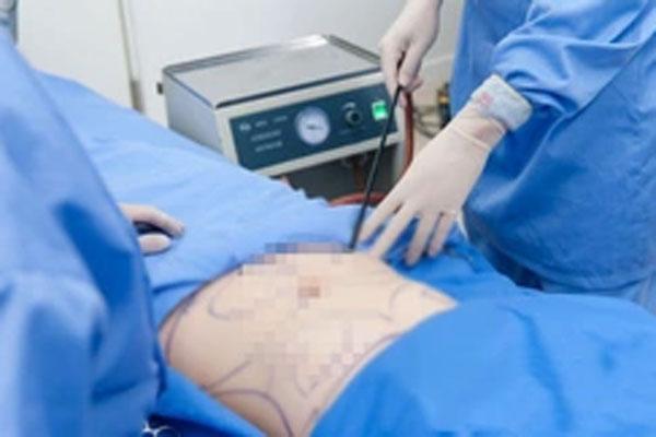 Người phụ nữ tử vong khi hút mỡ bụng ở TP.HCM-1