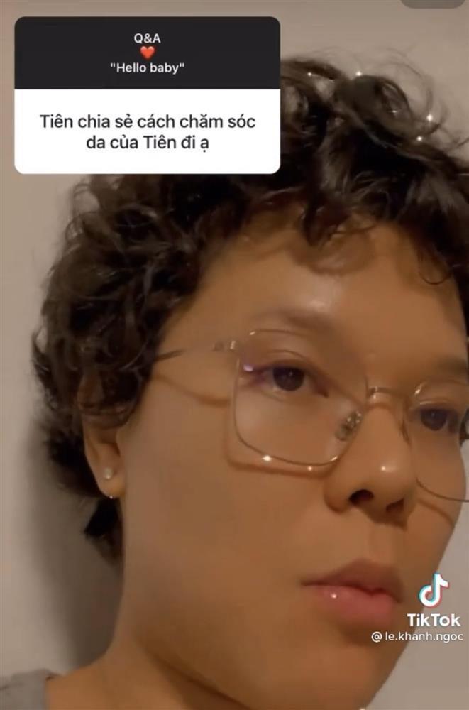 Ngã ngửa cách trị mụn ẩn hiệu quả không tưởng của Tiên Tiên-1